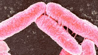 Microscope image of Escherichia coli bacteria shown in pink against a dark background