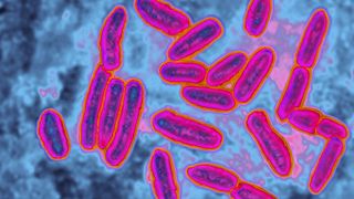 Microscope image showing pink rod-shaped bacteria against a blue background