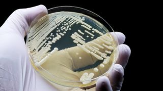 A gloved hand holds a petri dish with a growing yeast culture in it