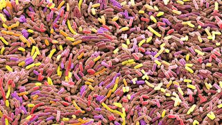 electron micrograph of Escherichia coli bacterial cells highlighted in red, yellow and pink