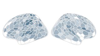 Two stylized images showing the size of the brain's gray matter.