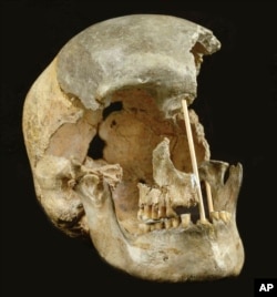 This picture provided by the National Museum, Prague shows the skull of an ancient man named Zlatý kůň, which was originally found in the Koněprusy caves in the Czech Republic. (Marek Jantač/ National Museum, Prague via AP)